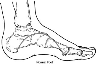 Flat Feet